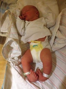 Peter Wahlund at birth - bilateral clubfoot