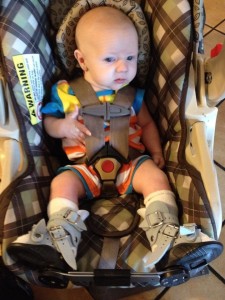 Peter in his Ponseti brace